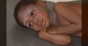 121 New Measles Cases in 3 Weeks: Utah's Crisis Deepens