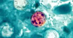 Cyclosporiasis outbreak slams Michigan & Ohio: Public health failure