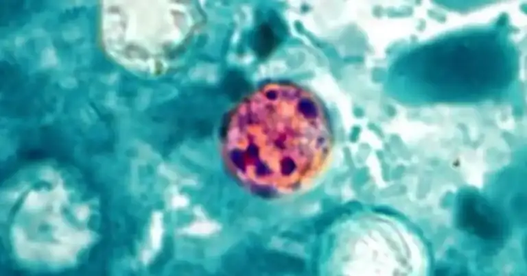 Cyclosporiasis outbreak slams Michigan & Ohio: Public health failure 2 Cyclosporiasis outbreak slams Michigan & Ohio: Public health failure